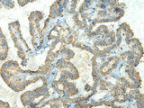 FCGRT Polyclonal Antibody