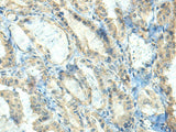 CTDP1 Polyclonal Antibody