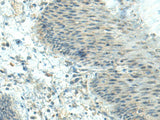 CTDP1 Polyclonal Antibody