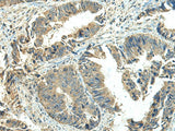 NPVF Polyclonal Antibody