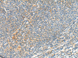 TSHB Polyclonal Antibody