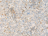 FECH Polyclonal Antibody