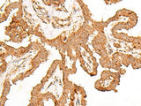 FER Polyclonal Antibody