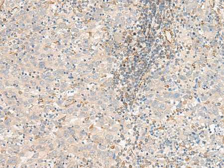 FER Polyclonal Antibody
