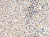 FER Polyclonal Antibody