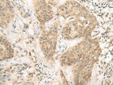 FERD3L Polyclonal Antibody