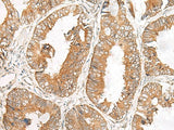 FERD3L Polyclonal Antibody
