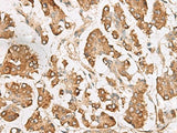 SLC40A1 Polyclonal Antibody