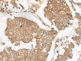 SLC40A1 Polyclonal Antibody