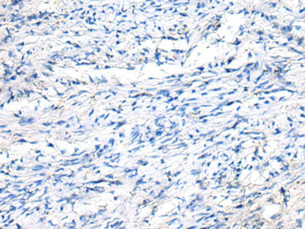 FGF11 Polyclonal Antibody