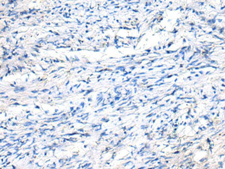 FGF11 Polyclonal Antibody