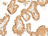 FGF13 Polyclonal Antibody