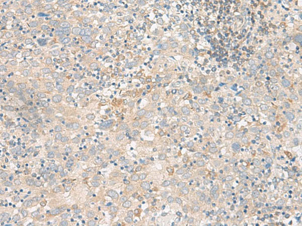 FGF13 Polyclonal Antibody