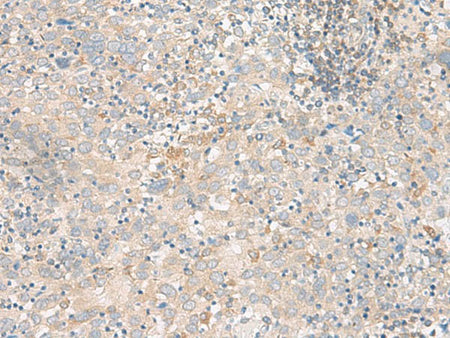 FGF13 Polyclonal Antibody