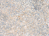 FGF13 Polyclonal Antibody