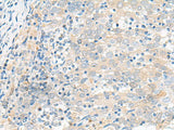 FGR Polyclonal Antibody