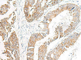 FGR Polyclonal Antibody