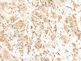 FIZ1 Polyclonal Antibody
