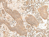 FIZ1 Polyclonal Antibody