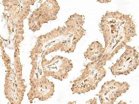 VPS50 Polyclonal Antibody