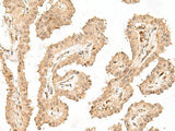 VPS50 Polyclonal Antibody