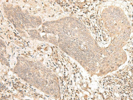 VPS50 Polyclonal Antibody