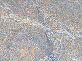 RNF207 Polyclonal Antibody