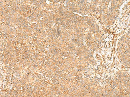 FLNC Polyclonal Antibody
