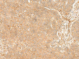 FLNC Polyclonal Antibody