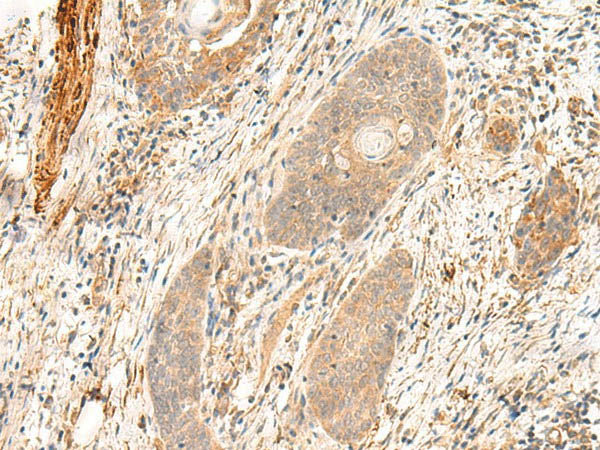 FLNC Polyclonal Antibody