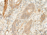 FLNC Polyclonal Antibody