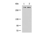 FLNC Polyclonal Antibody