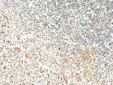 FNBP1L Polyclonal Antibody