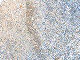 FNBP1L Polyclonal Antibody