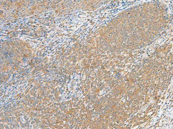 FOLR1 Polyclonal Antibody