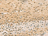 FOXH1 Polyclonal Antibody