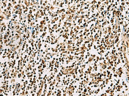 FOXI1 Polyclonal Antibody