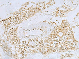 FOXQ1 Polyclonal Antibody