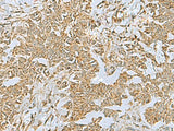 FAAP100 Polyclonal Antibody