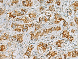 FAAP100 Polyclonal Antibody