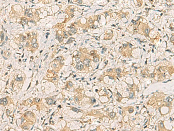 SQSTM1 Polyclonal Antibody