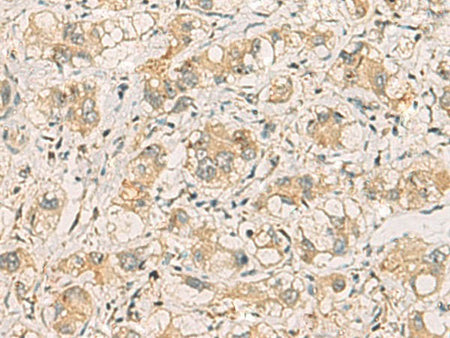 SQSTM1 Polyclonal Antibody