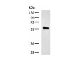 SQSTM1 Polyclonal Antibody