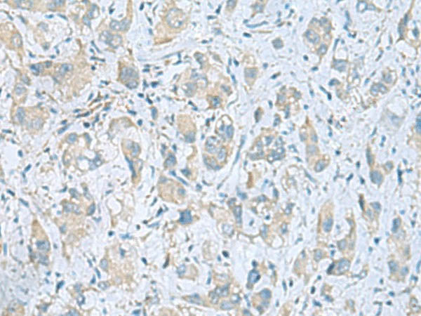 PLN Polyclonal Antibody
