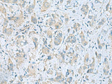 PLN Polyclonal Antibody