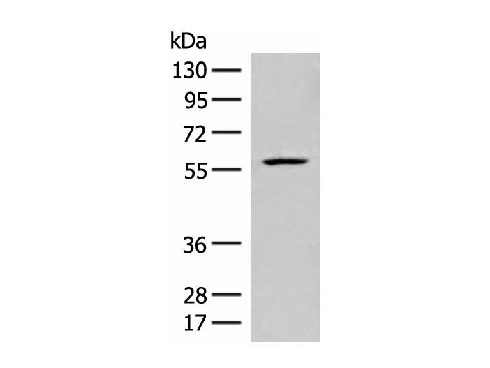 FKTN Polyclonal Antibody