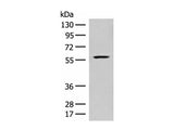 FKTN Polyclonal Antibody