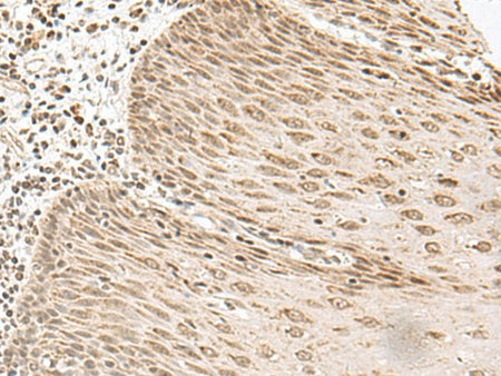 LGALS4 Polyclonal Antibody