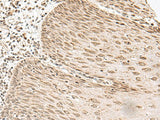 LGALS4 Polyclonal Antibody