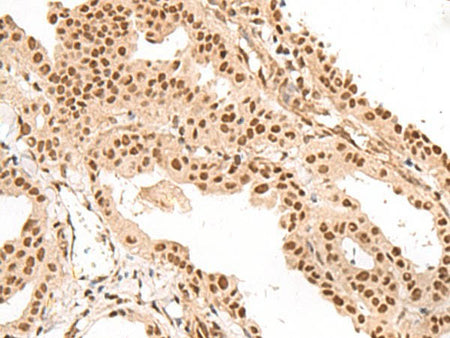 LGALS4 Polyclonal Antibody